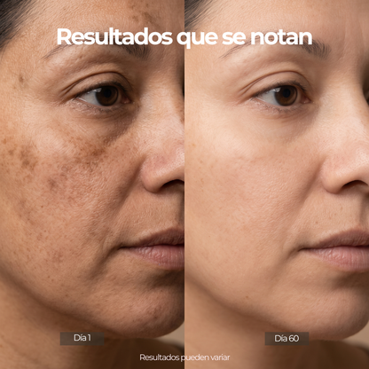 Lumara LuxLift™ + Envio Gratis + Regalo