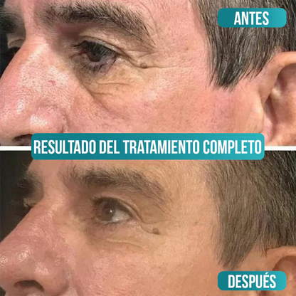 Crema Antiedad Masculina Sadoer con Vitamina C, Ácido Hialurónico y Niacinamida + Envio Gratis